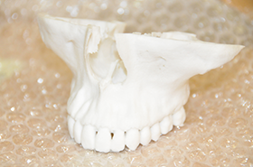 3D模型（立体的な実寸サイズの顎骨模型）について