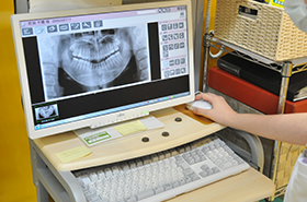 上下顎骨全体のレントゲン写真の画像診断